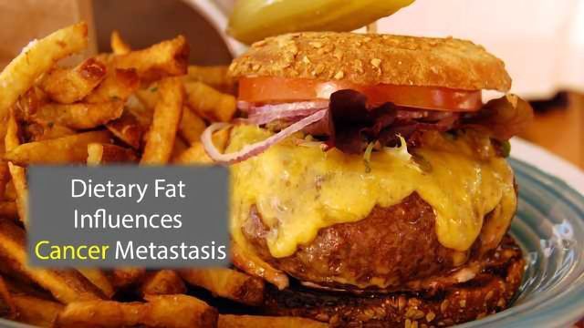 Dietary Fat Metabolism May Promote Metastasis content piece image 