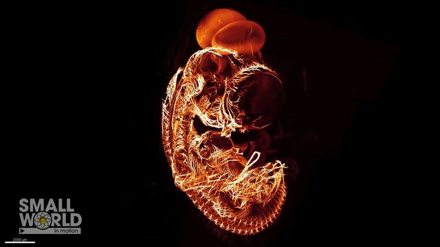 Fly Through the Nervous System of a 7-Day Chicken Embryo content piece image 