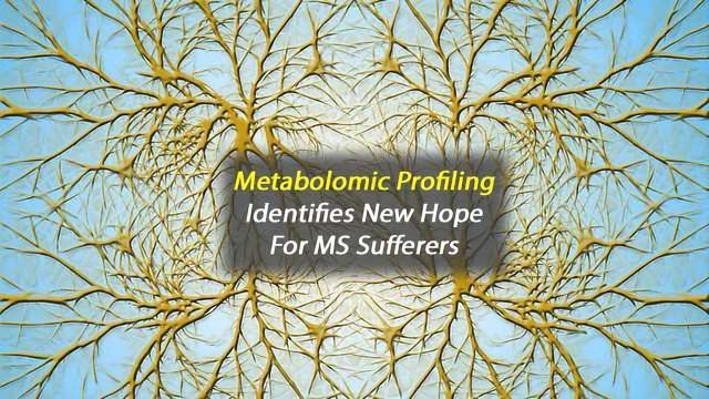 Metabolomic Profiling Identifies Taurine as New MS Therapeutic content piece image 