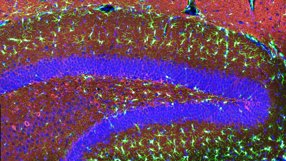 Human microglia implanted in the hippocampus region of the brain of a mouse.