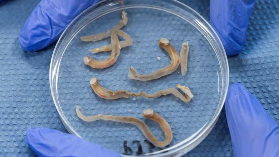 Petri dish of worms