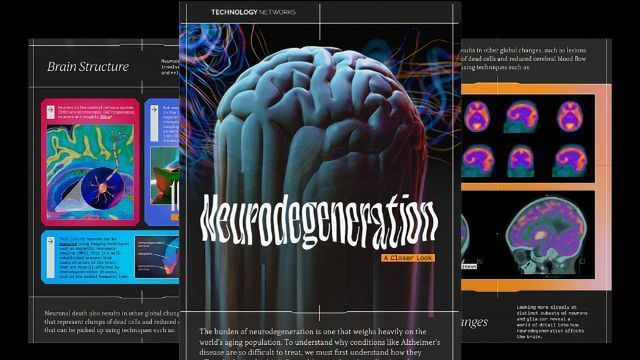 Neurodegeneration: A Closer Look content piece image 